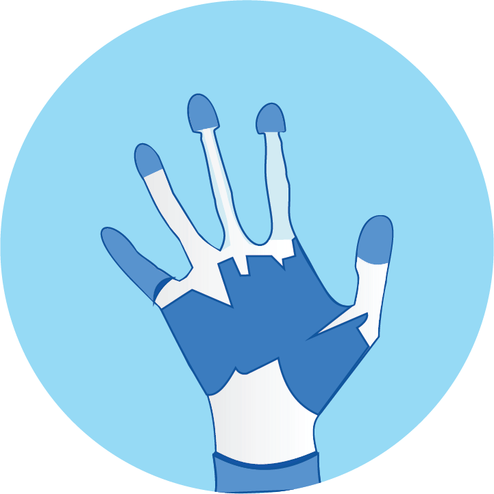 Soft Tissue Injuries